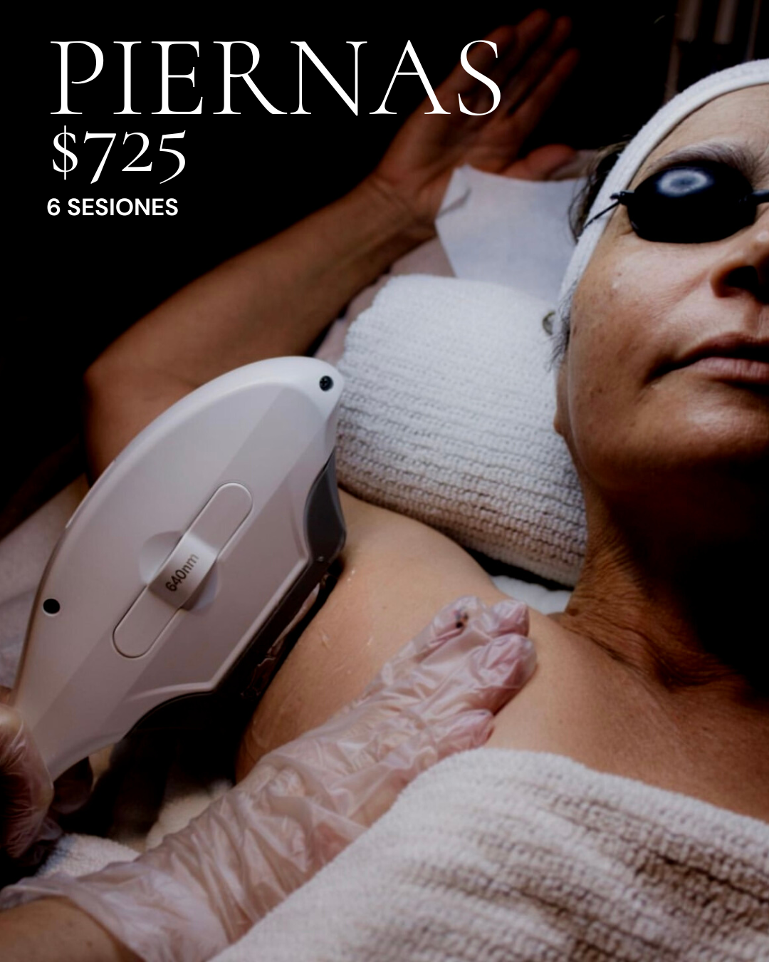 It's summer yet? IPL